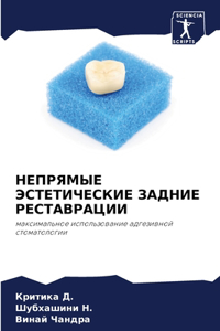 НЕПРЯМЫЕ ЭСТЕТИЧЕСКИЕ ЗАДНИЕ РЕСТАВРАЦИ&