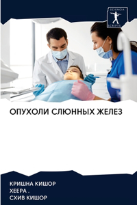 ОПУХОЛИ СЛЮННЫХ ЖЕЛЕЗ