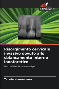 Risorgimento cervicale invasivo dovuto allo sbiancamento interno ionoforetico