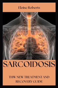 Sarcoidosis
