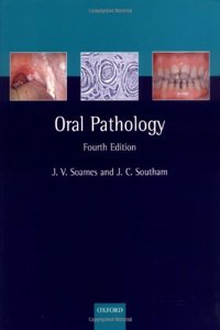 Oral Pathology