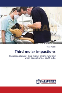 Third molar impactions