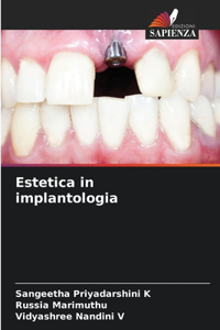 Estetica in implantologia