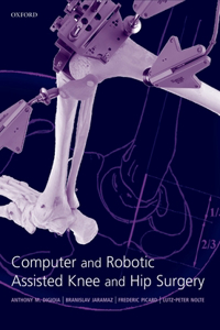 Computer and Robotic Assisted Hip and Knee Surgery