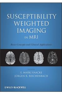 Susceptibility Weighted Imaging in MRI