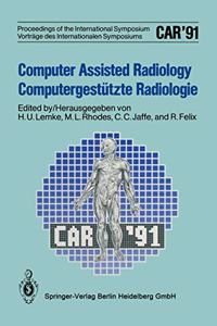 Computer Assisted Radiology / Computergesta1/4tzte Radiologie: Car '91 Computer Assisted Radiology