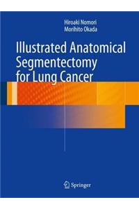 Illustrated Anatomical Segmentectomy for Lung Cancer