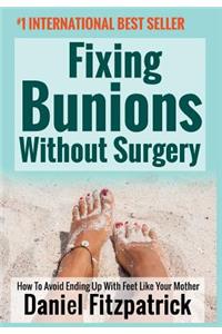 Fixing Bunions Without Surgery