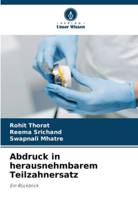 Abdruck in herausnehmbarem Teilzahnersatz