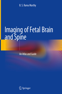 Imaging of Fetal Brain and Spine