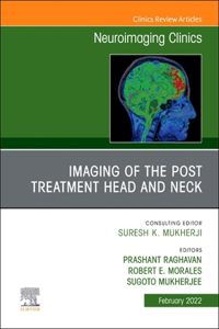 Imaging of the Post Treatment Head and Neck, an Issue of Neuroimaging Clinics of North America