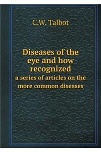 Diseases of the Eye and How Recognized a Series of Articles on the More Common Diseases