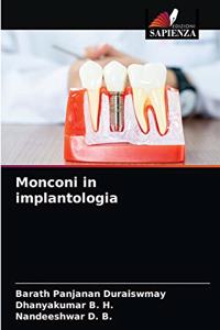 Monconi in implantologia