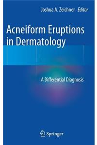 Acneiform Eruptions in Dermatology: A Differential Diagnosis