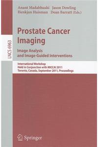 Prostate Cancer Imaging