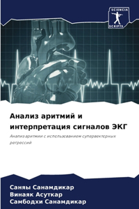 Анализ аритмий и интерпретация сигналов Э