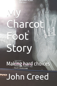 My Charcot Foot Story