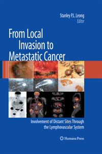 From Local Invasion to Metastatic Cancer