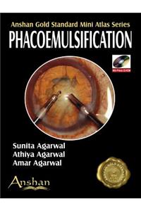 MINI ATLAS OF PHACOEMULSIFICATION