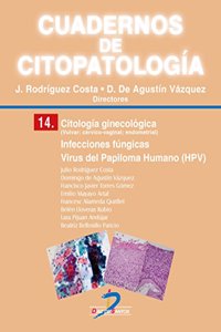 Citologia ginecologica: Infecciones fungicas. Virus del Papiloma Humano (HPV)