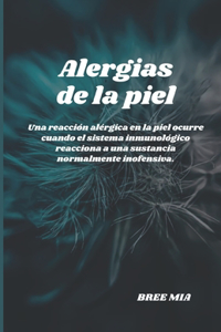 Alergias de la piel