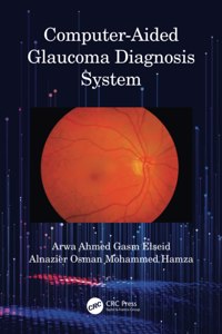 Computer-Aided Glaucoma Diagnosis System