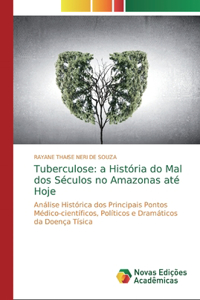 Tuberculose