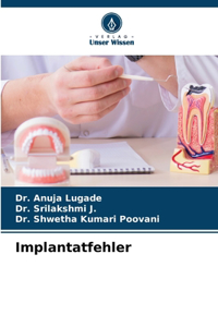 Implantatfehler