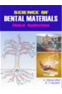 Science of Dental Materials: Clinical Applications