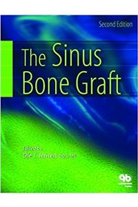 The Sinus Bone Graft