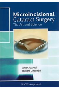 Microincisional Cataract Surgery