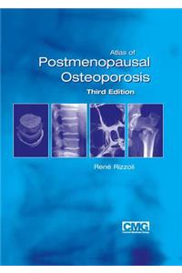 Atlas of Postmenopausal Osteoporosis