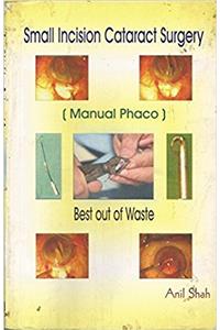 SMALL INCISION CATARACT SURGERY (MANUAL PHACO) BEST OUT OF WASTE(WITH CD ROM)