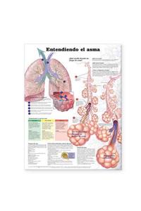 Understanding Asthma Anatomical Chart in Spanish (Entendiendo El Asma)