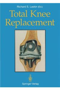 Total Knee Replacement