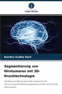 Segmentierung von Hirntumoren mit 3D-Drucktechnologie