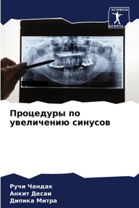 Процедуры по увеличению синусов