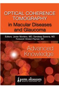 Optical Coherence Tomography in Macular Diseases and Glaucoma: Advanced Knowledge
