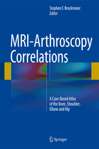 Mri-Arthroscopy Correlations