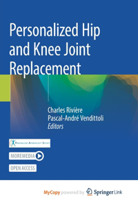 Personalized Hip and Knee Joint Replacement