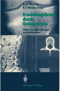 Ermüdungsbruch Durch Osteoporose