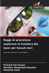 Raggi di precisione
