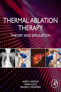 Thermal Ablation Therapy