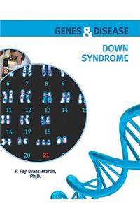 Down Syndrome