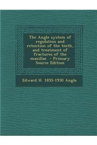 The Angle System of Regulation and Retention of the Teeth, and Treatment of Fractures of the Maxillae