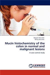 Mucin Histochemistry of the Colon in Normal and Malignant Lesions