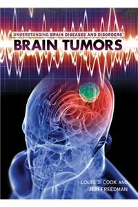 Brain Tumors