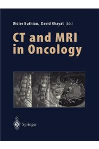 CT and MRI in Oncology