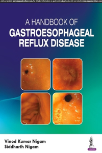 A Handbook of Gastroesophaegeal Reflux Disease (GERD)