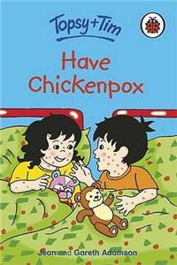 Have Chickenpox
